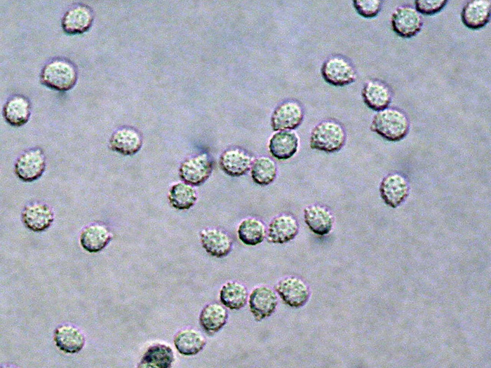 Phlebiella...(Phlebiella ardosiaca)